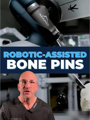 🤖 Bone Pins & Arrays: Precision Behind Robotic Hip and Knee Replacement . Ever wondered how robotic-assisted #jointreplacement achieves precision in the operating room?  During robotic-assisted procedures, specially designed tracking arrays act as GPS markers for the surgical robot. These arrays, mounted on pins carefully placed in the bone, create a real-time 3D map of your joint anatomy. Think of them as sophisticated motion sensors that help the robot understand exactly where your bones are at all times during surgery. . The process starts with strategic pin placement - either through small separate incisions or within the main surgical site. These pins serve as secure anchors for the arrays, which contain specialized reflective markers tracked b y the system's advanced cameras. The cameras continuously monitor these markers, allowing the surgical robot to maintain sub-millimeter accuracy throughout the procedure. This technology has the ability to compensate for any movement during surgery. Whether it's a slight shift in position or intentional repositioning of the leg, the tracking system maintains precise spatial awareness, ensuring that every bone cut and implant placement is exactly where it should be. The tracking arrays can detect movement as slight as 0.1mm - that's about the thickness of a human hair! #RoboticSurgery #OrthopedicSurgery #hipreplacements #kneereplacement  . 👇 What questions do you have about Robotic-assisted Hip or Knee Replacement? . . 🎥 Stryker Mako SmartRobotics™️ Joint Replacement System