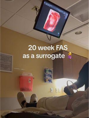 Anatomy scan for baby girl was soo goodn So glad my sister in law snuck these cute videos for the parents! #19weekspregnant #anatomyscan #20weekspregnant #surrogatelife #gestationalsurrogacy #surrogacyjourney #pregnant 