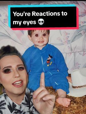 Replying to @kira_0000000002 By far my favorite video, Seeing YOUR reactions to my eyes 💀 #fyp #megalocornea #bigeyes #BabyPicture #BrownEyes 