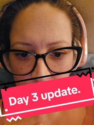 I really do know how lucky I am. What do I mean by that? I mean that I'm super grateful for having an amazing green flag husband who bends over backwards to take care of me because we're also lucky that he gets to work from home. #surgery #uterinerupturestory #uterinerupturesurvivor #uterinerupture #hysterectomyrecovery #hysterectomy #greenflaghusband   #creatorsearchinsights 