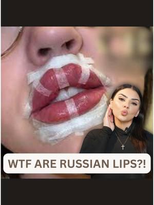 MAN…have I beat this conversation to a pulp, yet? 😅   LUCKILY…I think we have collectively, or at least reputable injectors have chosen to drop the gimmicky “Russian Lips” marketing strategy. I have yet to see a LICENSED, United States educated provider use a true “Russian lip technique,” and that’s a BLESSING, trust me (listen to the vid to find out why).   If you’ve ever heard me speak or been to one of my presentations then you know that the ONLY time the words Russian Lips should come out of an injectors mouth, is if you just did your patient’s lips and he/she IS OF RUSSIAN DECENT. Let’s hear it for MOTHER RUSSIAN 🇷🇺🪆  And with that...let’s bid the Russian Lips adieu in 2025…🫡  SO LONGGGGG ✌️ #russianlipstechnique #russianlips #russianlipstraining #lipfillertechnique #nunestepanyan #thestepanyanclinic 