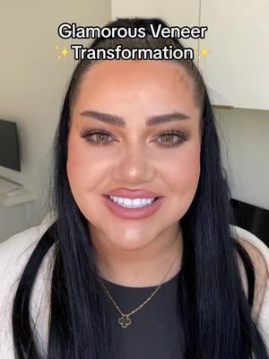 Glamorous Veneer Transformation ✨ #veneers #porcelainveneers #glamveneers #hollywoodsmile #brightersmile #glamour #veneertransformation #smilemakeover 