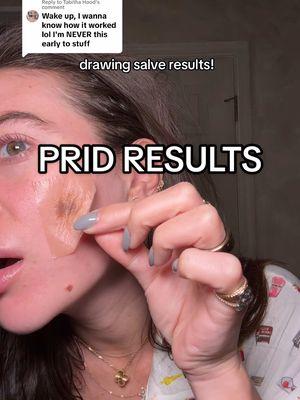 Replying to @Tabitha Hood HOORAYYYY #drawingsalve #prid #pimples #breakouts #drawing #solution 