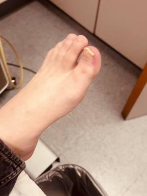 1. BONE SPUR REMOVAL 2. ORAL ANTIFUNGAL 3. LASER ……now WHO WANTS TO REMOVE FUNGUS WITH RESULTS😌………#nailfungu#nailfungus #footcareu#nailfungusremovalu#nailfungustreatmente#mt#foothealth #podiatryf#diabeticfootcareo#nailss#podiatristu#toenailfunguso#ingrowntoenails #skincaref#athletesfoot #toenailse#healthyfeeto#footdoctorw#to#ingrowntoenail##bunionsf#funguso#feetu#footfungusf#fungalinfectionu#toenailfungustreatmente#hammertoet#achillestendonitist#nailhealth #blogs