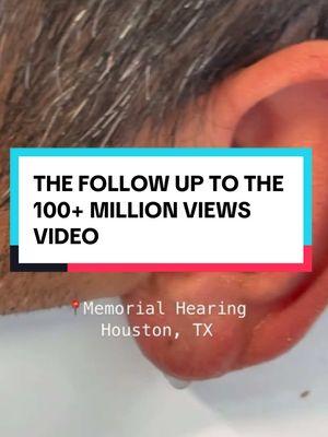 The most requested video- uploaded again bc nobody can seem to find it- HEAR ya go! 👂 #100million #earwax #earwaxremoval #earigator #doctorelly #houston #memorialhearing #earirrigation 