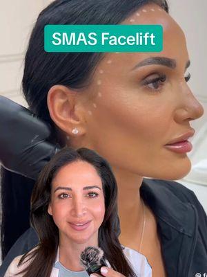 Debunking the SMAS non-surgical facelift with Dr. Sylvia. What are your thoughts?  #smasfacelift #facelift #smas #beautytrends #aestheticdoctor #plasticsurgery #BeautyTok 