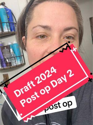 Draft from May 2024 day 2 post op from a panniculectomy! #panniculectomyjourney 