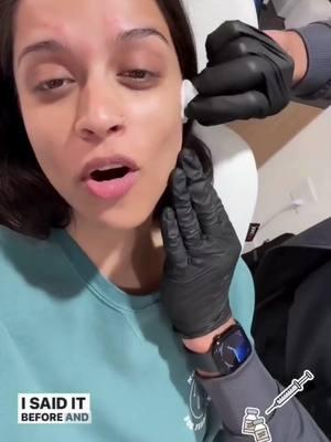 Lilly Singh, the talented Canadian YouTuber, television host, comedian, and author, trusts Dr. Milan Shah for her Botox treatments! 💉✨ Enhancing natural beauty with expertise and care, Dr. Shah ensures stunning results every time. Want to glow like Lilly? Book your consultation today! 🌟 #BotoxWithDrShah #NaturalGlow #BeautologieAesthetics #Beautologie #LillySingh #LillySinghBotox #BeautologieBotox #MedicalAesthetics #ClenchingMuscle #RelaxMigraines #WrinkleRelaxers