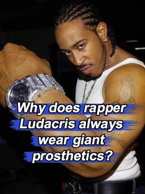 Why does rapper Ludacris always wear giant prosthetics He even owns the biggest shoes in the world. #Ludacris #rapper #usa #fyp #foryou #celebrity 