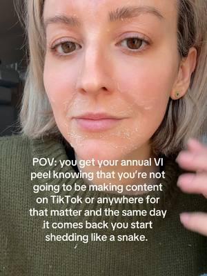 When TikTok comes back and all you want to do is make content but you look like a snake shedding its skin or Buffalo Bill had his way with you. Ps. I LIVE by these @VI Peel , and all people have been saying is “you don’t need a peel your skin is great” EXACTLY!! I do these to keep my skin looking great. #welcomebacktiktok #chicagoinfluencers #chicagoland #chicagomom #chemicalpeel #chicagonorthshore 