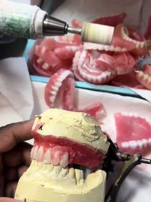 Are Your Dentures Really Fitting Right?!”Behind every perfect smile is the precision and care that goes into crafting it. 🦷✨ Watch how we transform raw materials into beautiful, functional dentures that bring confidence and comfort. Every detail matters when it comes to creating the smile you deserve. Let me know what you think in the comments below! 💬 #CraftingConfidence #Dentures #SmileTransformation #CustomDentures #BeautifulSmiles #DentureCare #HandcraftedSmiles #DentureArt #ConfidenceBoost #SmileWithConfidence #DentureCraftsmanship #QualityMatters #DentureLife #SmileGoals #ArtOfDentistry #DenturesDoneRight #Prosthetics #PerfectSmile #SmileJourney #TransformYourSmile #SmileCare #HealthySmiles #DentureLab #DentureWorks #CustomProsthetics #SmileDesign #PrecisionDentures #DentureLove #DentureSolutions #SmileRestoration #CraftedWithCare #DenturesByDesign #SmileBuilders #TopDentures #QualityProsthetics #SmileCreation #ConfidenceInEverySmile #BestDentures #SmileStories #SmileExperts #RealSmiles #SmileArtistry #SmileMagic #MadeToFit #NaturalSmiles #AdvancedDentures #ComfortableSmiles #DentureGoals #YourPerfectSmile #AffordableDentures #SmileConfidence #SmileTransformationJourney #RestoredConfidence #HandmadeSmiles #SmileBoost #PersonalizedSmiles #ExpertCraftsmanship #FlawlessSmiles #TopQualityDentures #DentureExperience #SmilePerfection #ProSmile #SmileRevamp #DentistryArt #MasterDentures #SmilePassion #SmileSculpting #EliteDentures #SmileInStyle #RevolutionaryDentures #SmileSecrets #SmileCreator #SmileVision #SuperiorDentures #SmilePrecision #SmileCreators #SmileImpression #SmileRevolution #ProCraftedDentures #ComfortRedefined #SmileUpgrade #DentureExperts #DreamSmile #UltimateSmiles #SmileInnovation #SmileSolutions #SmileGenius #SmileDetails #SmileQuality #PremiumDentures #SmileDedication #SmileEvolution #SmileReimagined #SmileInFocus #CraftedSmiles