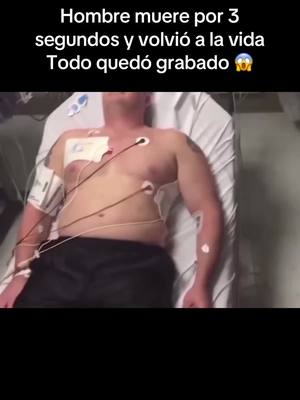 😱SOLORENDENTE😱#viral #parati #muerte#vida#paranormal#solorendente#grabando #tiktokhazmeviral #desconocida #broma #tiktok #tendencia #paratodoelmundo #paratodos #fypシ 