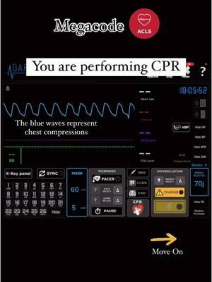 ACLS Megacode - According to 2020 AHA ACLS  Challenge yourself!  #acls #cardiology #ekgtraining #medicalstudents #tampamedical