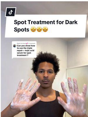 Replying to @Amari💕 spot treatment for dark spots and stubborn hyperpigmentation! ##darkspottreatment##darkspotserum##darkspotskincare##skincarefordarkspots##evenskintone##spottreatment