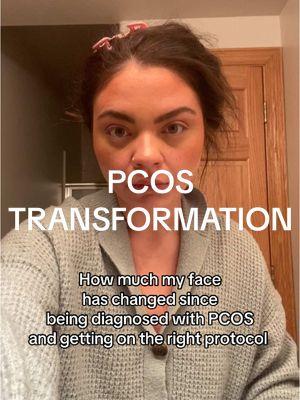 Navigating PCOS without the proper diagnosis and protocol almost sent me over the edge. I share all my recipes and workouts on IG 💪🏼 #cyster #cystersupport #pcos #pcosawareness #pcosexperience #womenshealth #healthtransformation #hormoneimbalance #nutritioncoach #womensnutrition #foodpsychology #pcoslife 