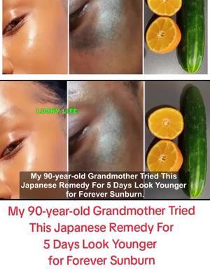 My 90-year-old Grandmother Tried This Japanese Remedy For 5 Days Look Younger for Forever Sunburn#skin #skincare #skincareroutine #beauty #skinwhitening 