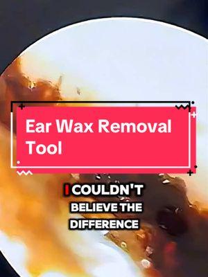 Ears wax is gross. #earwax #earwaxremmoval #earwaxremovaltok #earwaxtool #hygiene #blackfriday #cybermonday