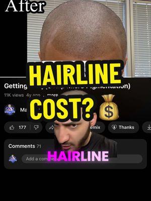 Replying to @Hass How Much Is A Hairline Tattoo?🤔 #recedinghairline #hairlinetattoo #scalpmicropigmentation #balding #baldmen #hairtransplant #marthreenez 