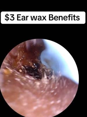 3 dollars was worth the investment next ill show you what a healthy ear looks like from the inside #earwaxremover #earwaxbenefits #TikTokShop  