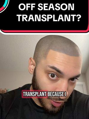 Replying to @Man_in_a_hat Off Season Hair Transplant?🤷🏻‍♂️🏀🤣 #hairlinetattoo #recedinghairline #hairtransplant #scalpmicropigmentation #baldmen #balding 