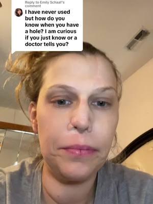 Replying to @Emily Schaaf #recovery #addictionrecovery #fckaddicition #dontdodrugs #foreheadnose #foreheadflap #rhinoplasty #addictiondestroyslives #addiction #nosejob #noseptum 