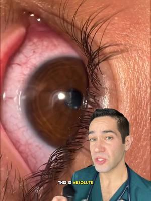 What do you think? #eye #bug #medical #newfearunlocked