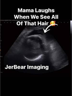 Mama laughs when she sees how much hair her baby has 🥰 #jerbearimaging #babyhairs #hair #momlife #fyp #Heartburn #hairybaby #babyvibes #cutebaby #motherhood #newmomlife #29weekspregnant #brownwoodtx www.jerbearimaging.com