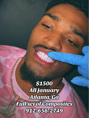 Full set of Composite veneers $1500  For the whole month of January 😁 #Savannahveneers #AtlantaVeneers #JacksonvilleVeneers #HoustonVeneers #veneers #compositeveneers #charlotteveneer #MiamiVeneers #neworleansveneers #TampaVeneers #Birminghamveneers #losangelesveneers #batonrougeveneers #memphisveneers #Cincinnativeneers #FortLauderdaleveneers #chicagoveneers #newyorkveneers 