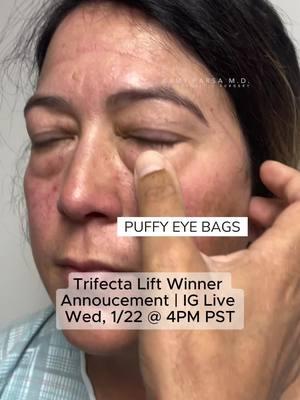 🚨Join us on IG LIVE Wednesday, January 22 as we announce the winner of the Trifecta Lift giveaway. 🗓️Wednesday, January 22 at approximately 4PM PST. 📞Contestants, be sure to have your phone by your side as the winner will receive a call from our office LIVE! ❤️See you then! #trifectalift #kamiparsamd