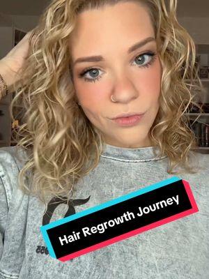 1yr Hair Regrowth Journey!! #HairRegrowthJourney #HealthyHairGoals #HairCareRoutine #GrowingMyHair #HairTransformation #HairGrowthTips #ScalpCare #HairCareInspo #RegrowYourHair #StrongerHairStrands #NaturalHairJourney #HairGrowthChallenge #HairRegrowthStory #FromThinToThick #HealthyScalpHealthyHair #HairRestoration #LongHairJourney #ThickerHairGoals #SelfCareRoutine #HairGrowthUpdate