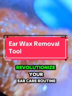 Ears wax is gross. #earwax #earwaxremmoval #earwaxremovaltok #earwaxtool #hygiene #blackfriday #cybermonday