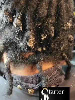 Trigger Warning 🚨🚨🚨!!! It's so important that you not ignore your clients when they come to you in this condition (possibly a form of Sebaceous Dermatitis). We have to make sure that we are treating them. In this particular case I used a clarifying shampoo, @madeforlocs detox bar, and glovers medicated shampoo. I also recommended that she go see my homie Jeff at the Herb shop at The vinings in Georgia for some vitamins and information on detoxing her body and then I just retwisted her with water.#starterlocqueen #thelocclinic #mfl #shampoo #detoxbar #gamechanger #locjourney #locsforlife #locorganics #loclife #sebaceous #dermatitis #locs #locstyles #atllocs #hair #naturalhair #king #teamlocs #blackmem  #freeform #locnation #wicks #wicknation  #interlocking #men #menlocstyles #gloversshampoo