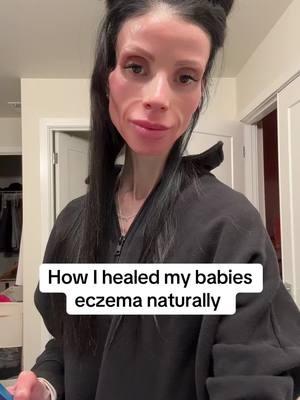 I healed my babies eczema without any steroids or medication after all the doctors said that was the only option. This why I feel the way I do about western medicine. @Nordic Naturals @MaryRuth's #MomsofTikTok #toddlermom #eczema #naturalhealing #holistichealth #skin 