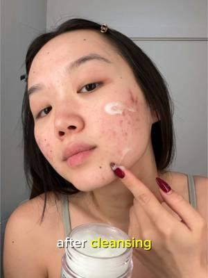 ✨ Say goodbye to the guilt of wearing makeup over acne! ✨ #acne #acneproneskin #pantothenicacid  #sensitiveskin #koreanskincare #kbeauty #skincare #moisturizer #numbuzin 