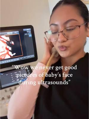 What can we say babies love us at new life ultrasound 👶🏻🩷 #ultrasound #ultrasoundtech #pregnancy #hdultrasound #pregnantlife #baby #2dultrasound #pregnant #thirdtrimester 