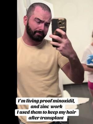 I always wondered if the minoxidil, zinc, finasteride, etc. was actually doing well. I found out the hard way it was working lol 😂 #apollostone1776 #apollostone #hairlosssolutions #hairloss 