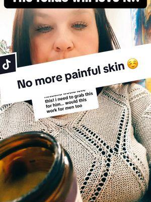 Replying to @Mandy I Budget Minded SAHM #painfulskincondition #dryskin #dryskincare #propolis #beeswax #mymagichealer #crackedskin #tiktokmademebuyit 