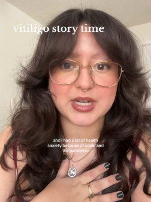 Replying to @paige vitiligo story time! #vitiligo #vitiligocheck 