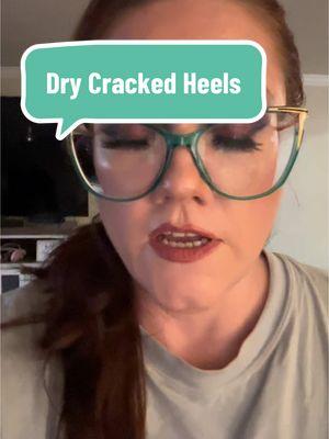 I was actually pleasantly surprised AF. My heels are so soft now! 🥹 @Dr. Frederick’s Original #crackedheelfix #softfeetgoals #heelcare #moisturizingsocks #footcaretips #selfcaremadeeasy #goodbyecrackedheels #TLCForfeet #TikTokShop #HealthyFeet #HappyFeetVibes 