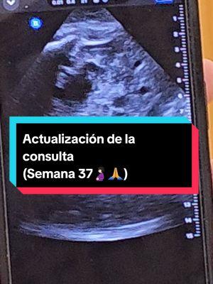 Otra semanita más ( Semana 37🤰🏻) #embarazada #pregnant #babyontheway #maternity #maternidad #baby #viral #37semanas #Vlog #bebeencamino #teamfebrero #teamembarazada #aprendeconanny 