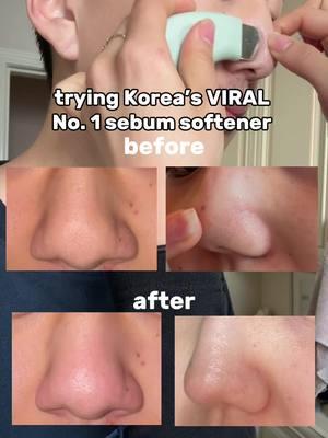 the before and after is CRAZY  #fyp #viralkoreanskincare #pores #blackheads #skincare #kbeauty #koreanskincare #kbeautyfinds #brother #koreanfamily #trendingskincare 