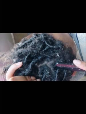 Dandruff scratching dreadlocks #asmr #asmrsounds #asmrhair #afrolocs #locs #afro #dandruff #dandruffscratching #nitpicking #scalpcheck #dandruffremovel #itchyscalp #dandruffflakes #bigflakes #flakes 