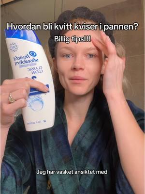 Head and shoulders har funket sååå bra for meg!! Hadde en periode der jeg hadde fungal acne(?) og det forsvant etter at jeg introduserte dette. Du kan enten dusje med det, eller rett og slett vaske ansiktet med det som jeg gjør. Billig tips, og synes selv den lukter såå godt. #billig#tips#hud#rutine#kviser#i#pannen#norsk#nordmenniusa#bli#kvitt#hvordan 