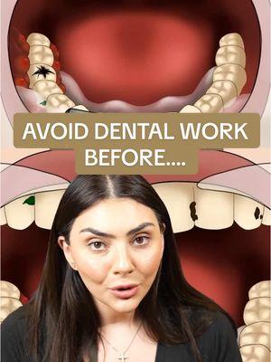 💉✨ Did you know? It’s best to avoid dental work for two weeks before & after getting toxins or fillers! 🦷 Why? Because dental procedures can introduce bacteria, cause swelling, and even shift your filler leading to complications that are hard to pinpoint. To keep your results flawless and minimize risks, schedule your dental visits at least two weeks apart from your injectables. Your glow (and your health) will thank you! ✨ #dentalwork #injectables #officememes #medspamemes #nunestepanyan #thestepanyanclinic #losangelesmedspa #