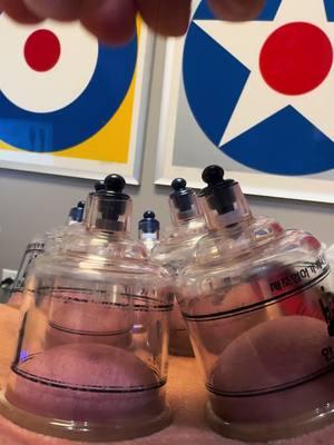 🏆 What is Cupping Therapy? ▪️ Cupping therapy involves placing cups on the skin to create suction, which lifts the muscle and fascia, promoting blood flow, reducing inflammation, and releasing deep-seated tension. ▪️ How it works: The suction created by the cups helps to release tight muscles, increase mobility, and improve recovery. It’s perfect for breaking up scar tissue or relieving soreness after a hard workout or competition. ▪️ Benefits: Cupping helps speed up recovery, reduce muscle pain, improve flexibility, and enhance performance—whether you’re a runner, lifter, or field athlete, this technique helps you stay on top of your game. ▪️ The experience: As the cups are placed, you’ll feel a firm pressure that lifts and separates the muscle tissue. After the session, your muscles will feel looser, lighter, and more mobile, helping you bounce back faster. ▪️ Who it’s for: Cupping therapy is ideal for athletes who deal with muscle tightness, post-training soreness, or anyone looking to improve recovery and flexibility. It’s a key tool sports chiropractors use to keep you moving and injury-free. #ChicagoChiropractor #SportsChiropractor #RoscoeVillage #CuppingTherapy #AthleteRecovery #SportsPerformance #MuscleRelief #InjuryPrevention #SportsChiropractic #MyofascialRelease #PainRelief #DrKyleRoss #DrKaitHoff #DrAdamAltman #MyofascialDecompression #PhysicalTherapy #SportsRecovery #FitnessRecovery #MobilityTraining #PerformanceRehab #ActiveRecovery #AthleteWellness #ChiropracticCare #SportsMassage #InjuryRecovery #MobilityFitness #FascialRelease #StrengthAndRecovery  As