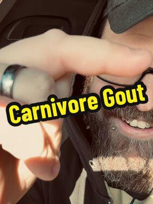 Woke up with swollen fingers and I’m pretty sure it’s gout #gout #carnivore #carnivorediet 