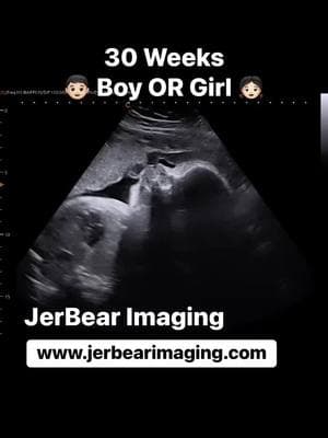 30 Weeks  #jerbearimaging #boyorgirlwhoknows #girlorboy #fyp #foryoupagereels #genderreveal #genderultrasound #pinkorblue #blueorpink #heorshe #visitbrownwood #ultrasoundnearme #imagingcenter #bookonline www.jerbearimaging.com