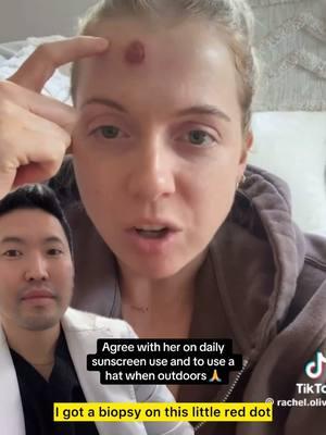 #duet and #stitch @Rachel 🍒 thank you for spreading #basalcellcarcinoma awareness and emphasizing sun protection including sunscreen! Many will come at us for promoting #sunscreenuse but the the evidence behind it does not lie! 💪 #evidencebasedmedicine #evidencebased #skincancer #skincancerawareness #drsugaiskincare 