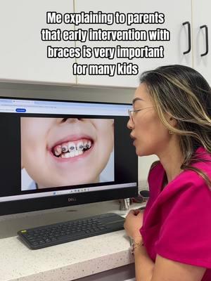 What age should my child get braces? This is a common question I get all the time. It really depends on how complex the case is and what our goals are. It's not just about straightening teeth. Early intervention with braces (Phase I ortho) often allows us to expand a narrow jaw structure so the child can breathe well, eat well, speak well, and in doing so, we are able to fit those teeth better and straighten teeth. By expanding at the right time, we can avoid extractions of adult teeth to fit them into the arch. Ask your dentist about early interceptive orthodontics/Phase I orthodontic treatment. #braces #pediatricdentistry #pediatricdentist #irvinedentist #ocdentist 