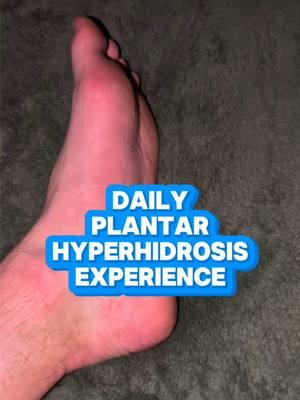 💧🦶🏼Did you know that excessive sweating of the feet can cause many issues ranging from redness and swelling, even athlete’s foot! #hyperhidrosis #excessivesweating #hyperhidrosiscommunity #hyperhidrosisawareness #sweat 